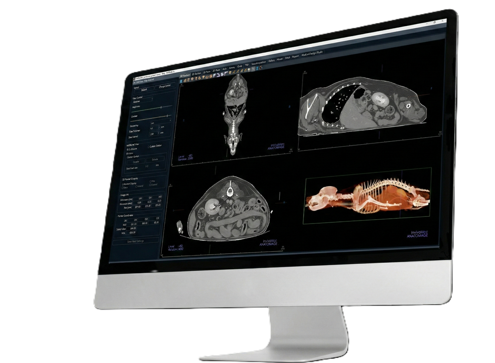 Invivo Guide Surgical Guide